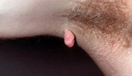 Pedicuren, wratbehandeling, steunzolen — foto 2