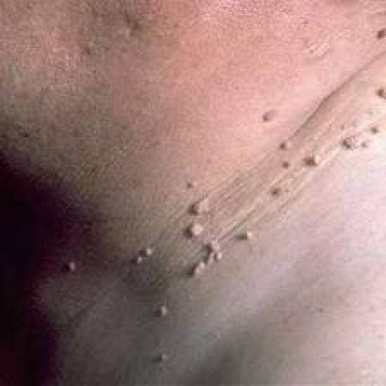Pedicuren, wratbehandeling, steunzolen — foto 3