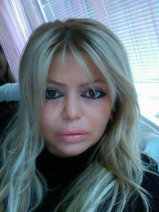 Definitief ontharen door middel van ipl is mogelijk bij schoonheidssalon AM aan huis beauty in Almel — foto 3