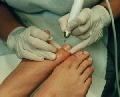 Pedicure